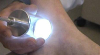 Laser wysokoenergetyczny Laser wysokoenergetyczny